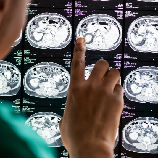 Medical Imaging Annotation